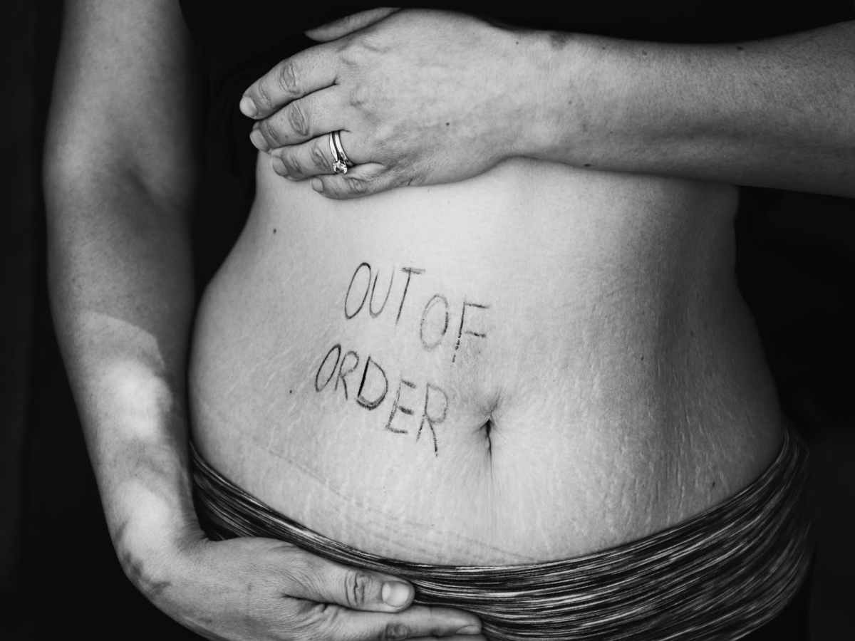 About GERD and Acidity